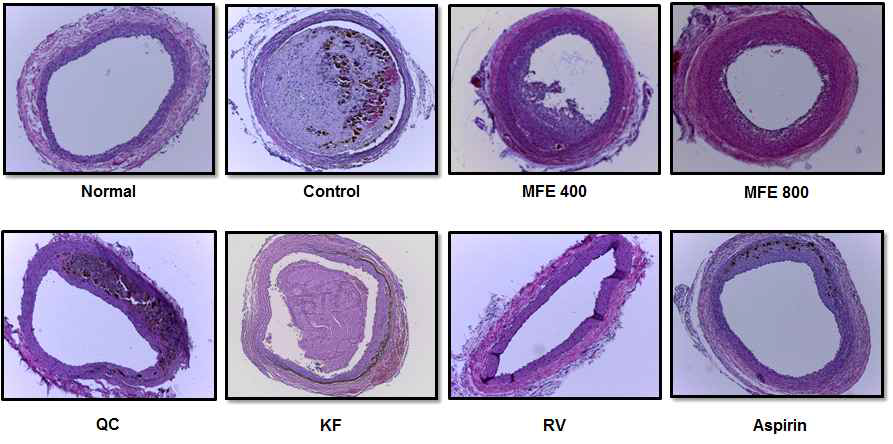 Effects of MFE and flavonoids on histological changes of blood vessels in topical FeCl3-induced carotid artery injury rat model.