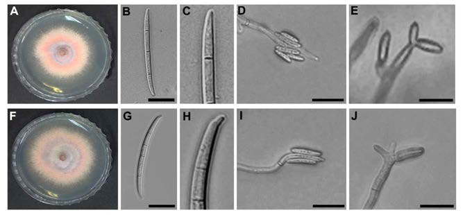 F. subglutinanas와 F. temperatum의 형태적 특징 비교