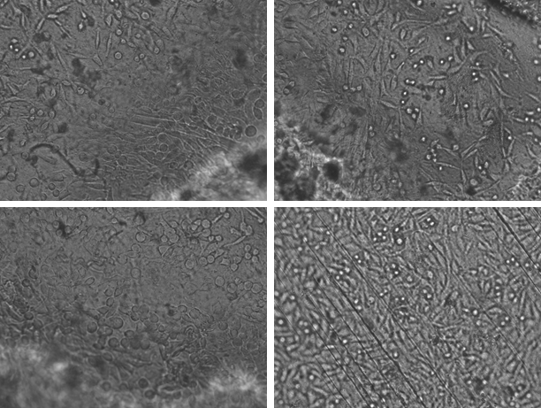 The ability of cell attachment with 5 % SCT