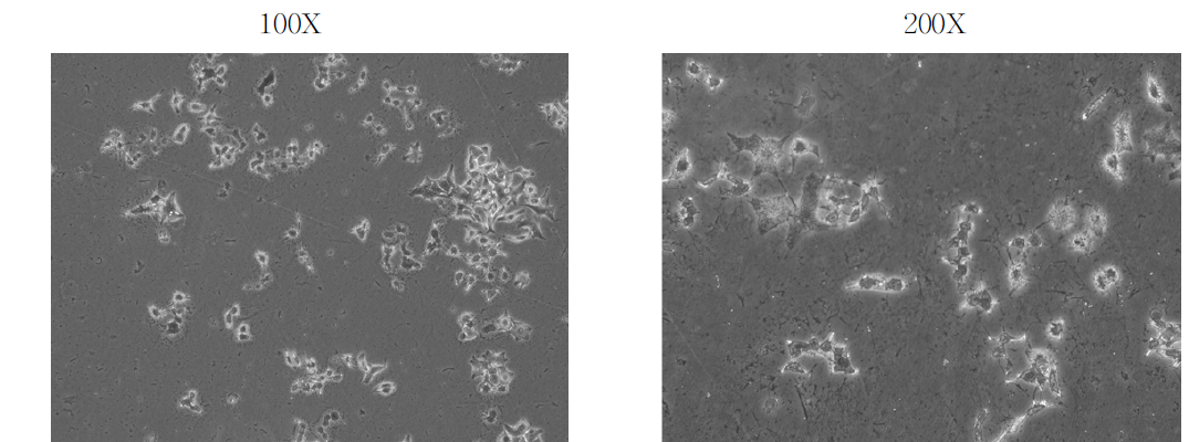 일반배지를 사용한 세포(Ishikawa cell)배양