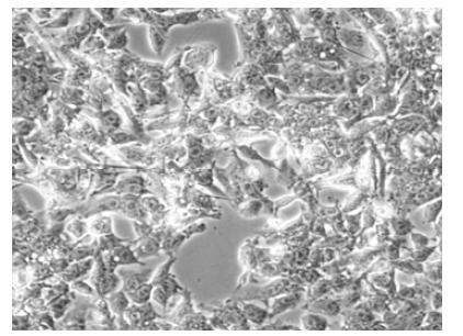 Culture morphology of HepG2 cells.