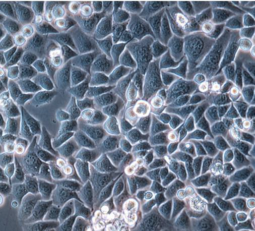 Culture morphology of AGS cells.