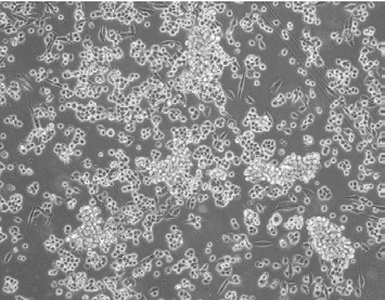 Culture morphology of MIA PaCa-2 cells.