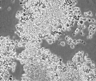 Culture morphology of PC12 cells.