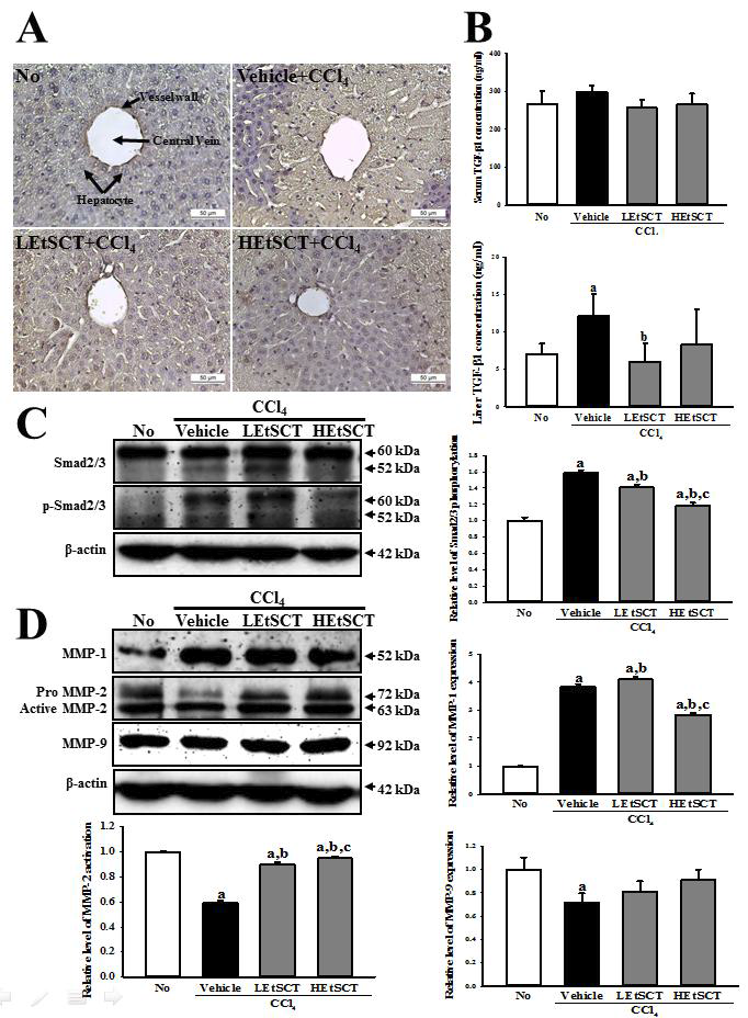 Alteration on the regulatory factors of liver fibrosis. (A) Immunohistochemistry of collagen protein. (B) ELISA for TGF-β1. (C) Western blot analysis for Smad2/3 expression. (D) Western blot analysis of MMP-1, 2 and 9 expression.