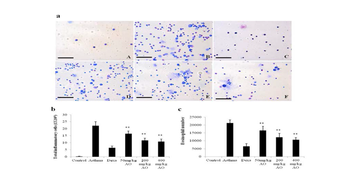 Effects of alginate oligosaccharides (AO) on the ovalbumin (OVA)-induced recruitment of total inflammatory cells and eosinophils in bronchoalveolar lavage fluid (BALF).