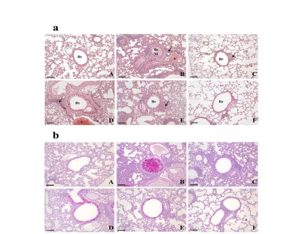 AO dose-dependently suppressed asthma-related histopathological changes in mouse lungs.