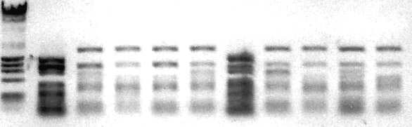 A representative finger printing of plasmid DNAs using Hinf Ⅰ① is pGBT9/RXRα sample. ②~⑩ : The plasmid samples were purified from yeast and cutted with HinfⅠ