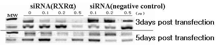 Reverse Transcriptase-PCR analysis in siRNA knock-down cells of retinoid X receptor α(upper panels) and β-actin (lower panels) in total RNA prepared from MCF-7 cell treat for retinoid X receptorα