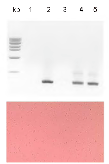 유전자변형 Halobacterium에 도입된 gas vesicle 유전자의 PCR 확인.