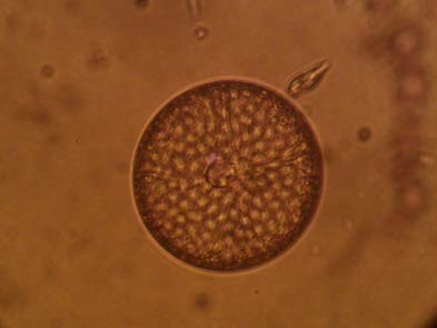 Coscinodiscus sp.