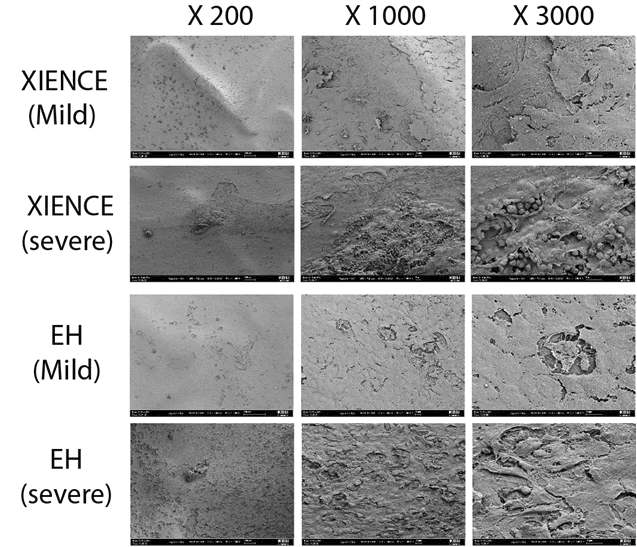 현재 시판되고 임상에서 효과가 입증된 sirolimus 계열의 everolimus가 코팅된 XIENCE사의 약물방출 스텐트와 본 연구팀에서 개발된 ETP 계열의 chaetocin 코팅된 스텐트간의 효과 비교 실험.