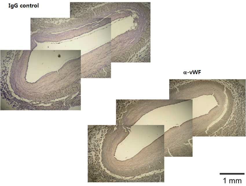 혈관내피세포 특이적 von Willi Brand factor 염색을 통해 멸균돼지 혈관의 내피세포 염색 예시. 스텐트 시술 후 재생된 혈관 내피세포 정도를 이 염색을 통해 비교 분석할 예정