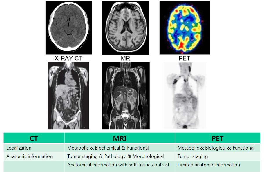 Characteristic of multimodality image