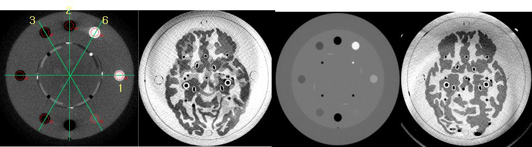 Brain phantom imaging