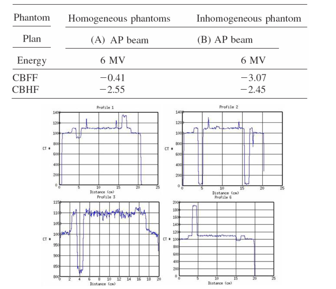 kVCone beam CT 와 planning CT에서 획득한 팬텀영상