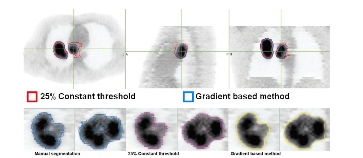 A comparison of constant threshold and gradient based method.