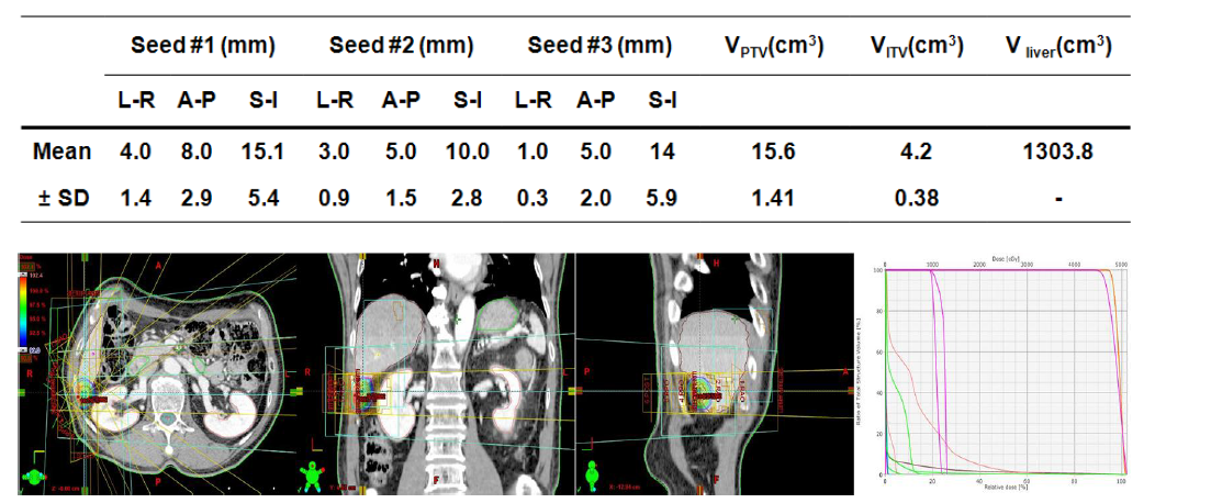 External beam planning with optimized tumor volume