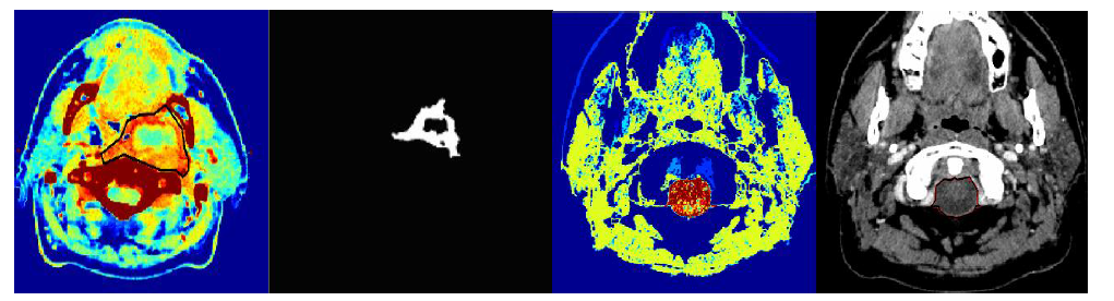 Brain voxel intensity map