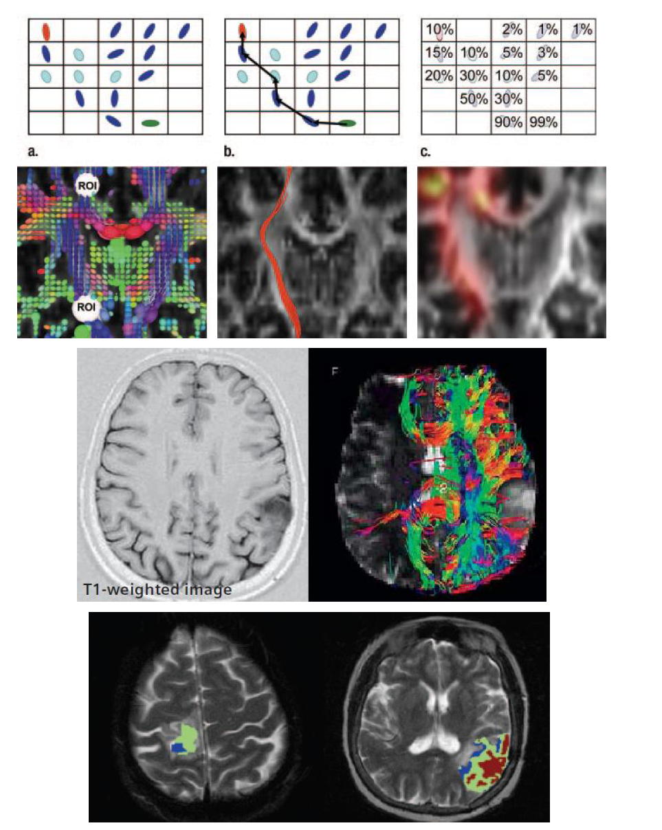 Diffusion tensor image map