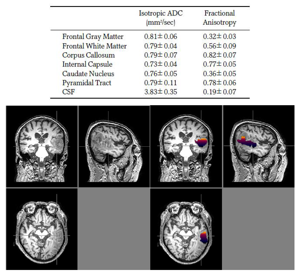 MRI ROI segmentaion