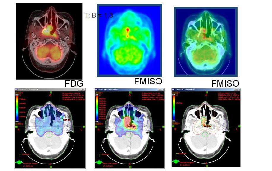 Hypoxic tumor imaging and FDG PET using image registration