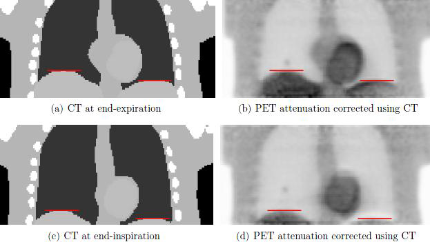 4D PET attenuation correction using 4D CT