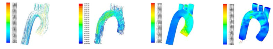 Pathlines and wall shear stresses at t=0.12 and 0.60