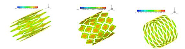 Effective Index for wall shear stresses (EIt) in the Between-Stent region for commercial stent models