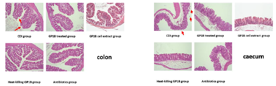 CDI 마우스 모델에서, GP1B 투여 후 2일 째에 관찰한 맹장과 결장의 조직학적 변화