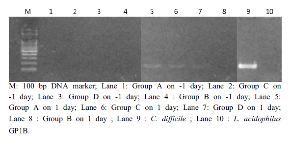 tcdA gene을 이용한 C. difficile 감염 여부 판정