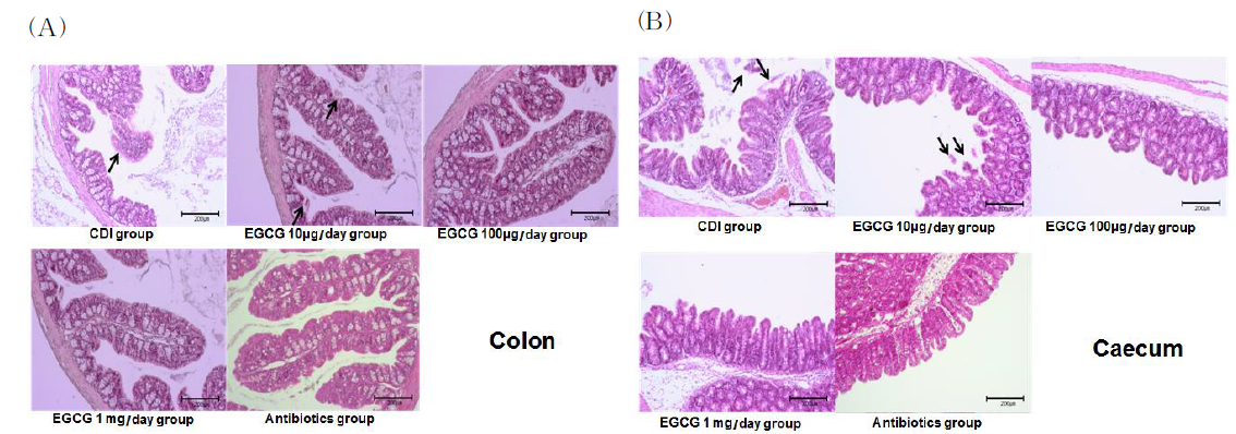 CDI 마우스 모델에서, EGCG 투여 후 2일 째에 관찰한 (A) 맹장과 (B) 결장의 조직학적 변화