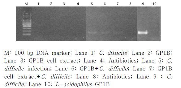 분변에서 DNA를 추출하여 C. difficile 027 tcdA gene 확인