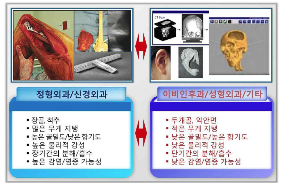 부위별 골결손 치료재료의 특성