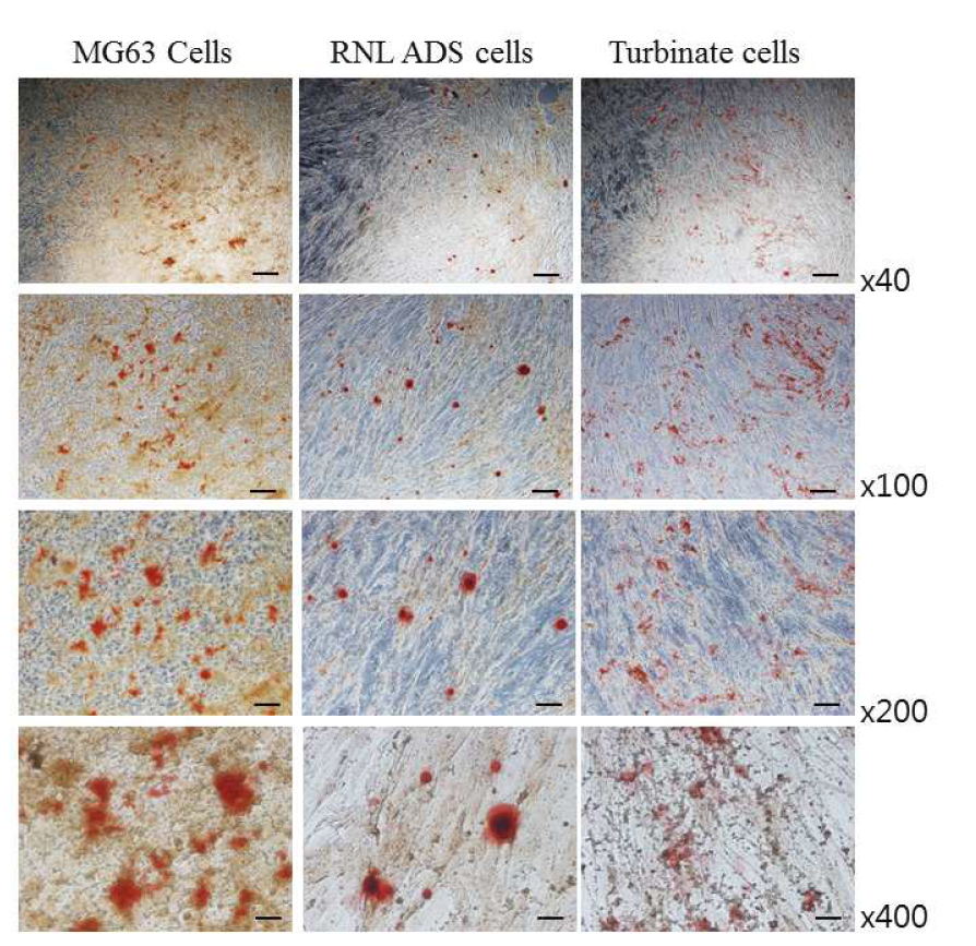 조골세포, 지방유래 줄기세포 및 비강으로부터 분리한 줄기세포의 Alizarin red 염색