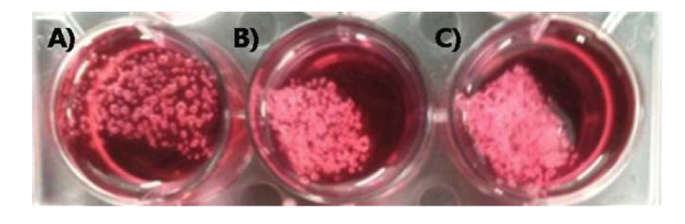 방사선 조사선량에 따른 DMEM Media에 담지된 5% 농도의 베타글루칸스케폴드 사진 (A) 0 kGy (B) 10 kGy (C) 5 kGy