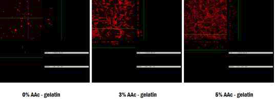 기능기 도입하여 고정화된 베타글루칸 지지체의 Confocal 분석