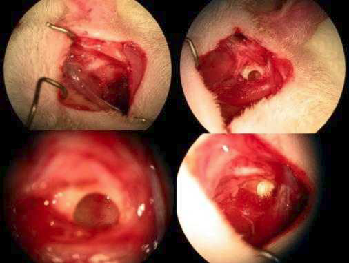 수술적 방법을 이용한 rat의 중이강 접근법과 개창술 후 중이강내를 관찰한 소견. 이후 지지체를 삽입한 소견