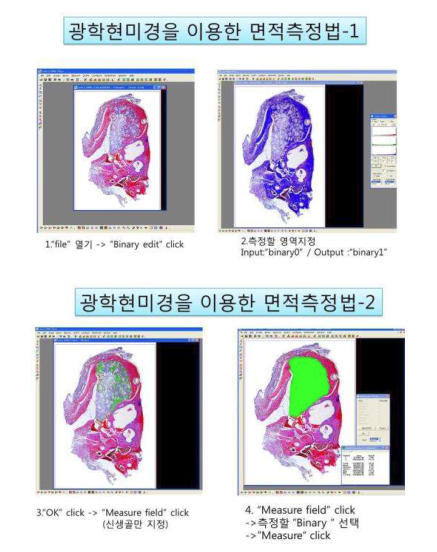 디지털 영상처리 프로그램을 이용한 신생골을 정량적 측정