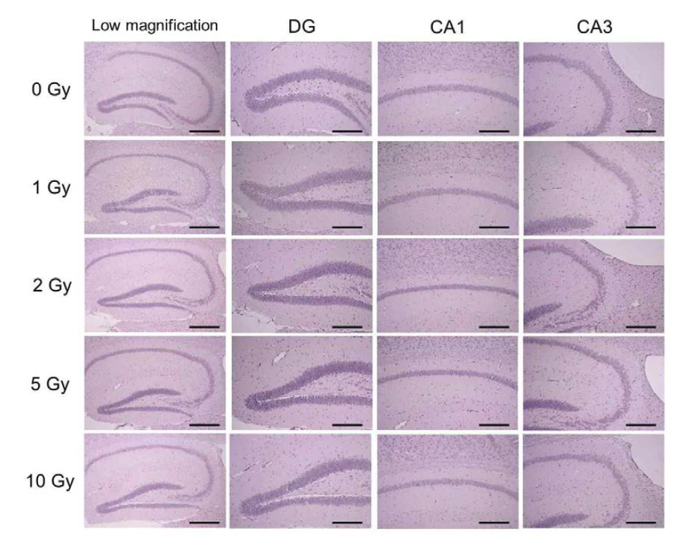 Histological results for the sham controls (sham irradiation of 0 Gy) and irradiated mouse hippocampus at 3 months after acute γ-irradiation.