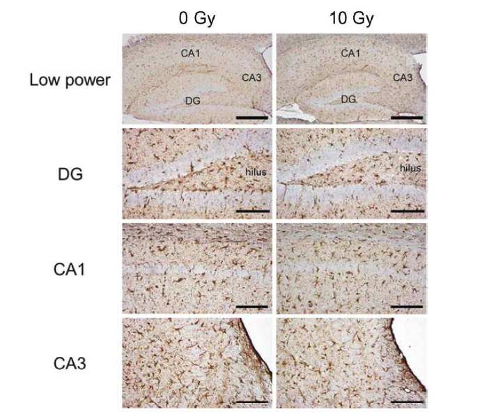 Cranial irradiation of high dose decreases astrocyte in the mouse hippocampus at chronic phase.