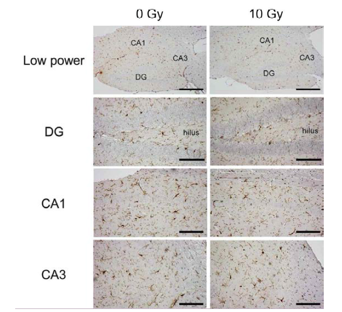 Cranial irradiation of high dose decreases microglia in the mouse hippocampus at chronic phase.