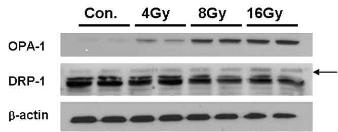 Effects of IR on mitochondrial dynamics-related proteins in Neuro-2a cells.