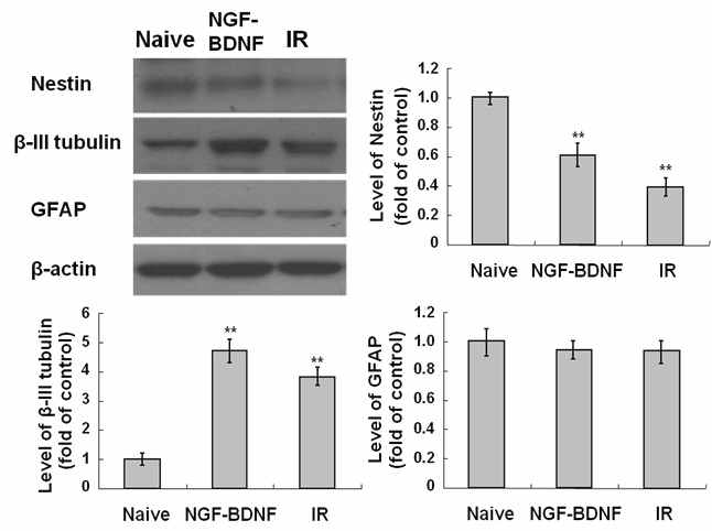 Induction of neuronal marker by IR in C17.2 cells