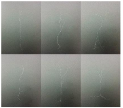 개별적으로 분리된 A사의 PTFE staple fiber