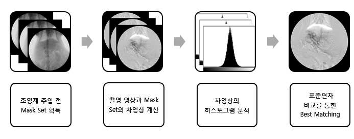 환자 움직임 추적 기반 고기능 DSA 기술 플로우 차트