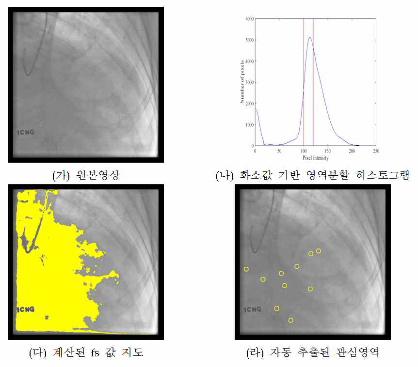 영상의 잡음을 자동으로 측정하는 알고리즘의 시각화