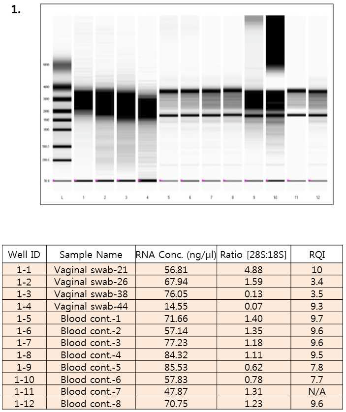 ExperionTM RNA StdSens를 이용한 RNA 샘플 정량 및 상태 확인 (1차)