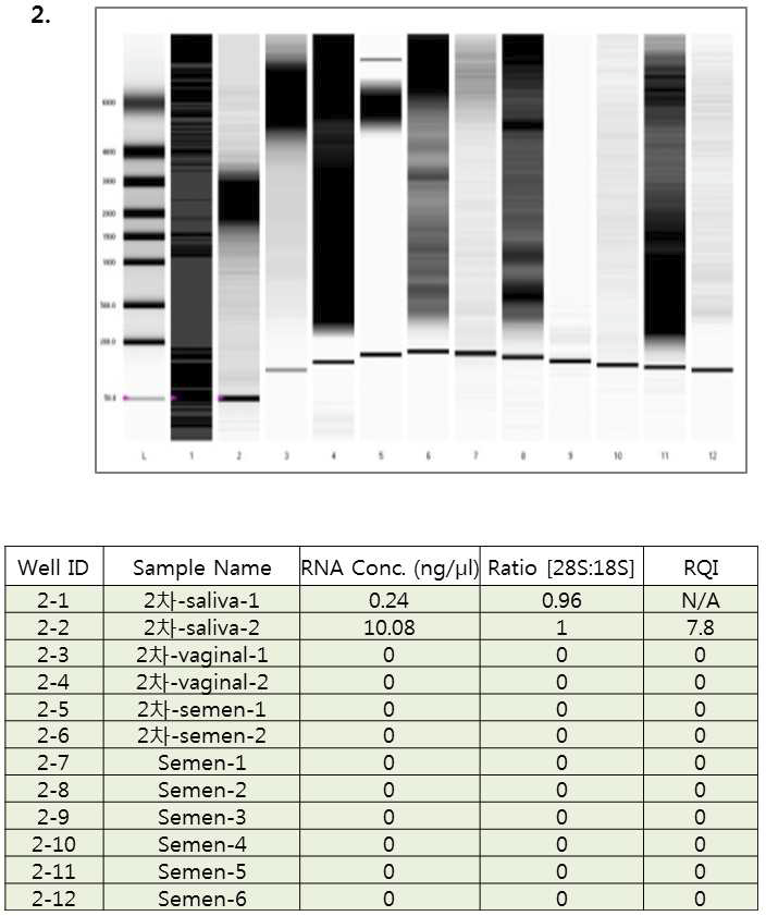 ExperionTM RNA StdSens를 이용한 RNA 샘플 정량 및 상태 확인 (2차).