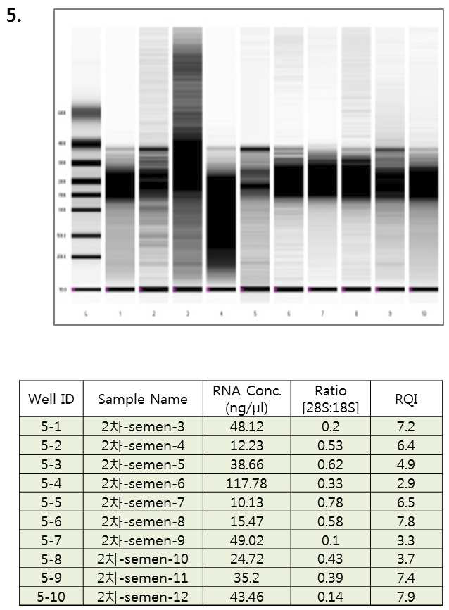 ExperionTM RNA StdSens를 이용한 RNA 샘플 정량 및 상태 확인 (5차)
